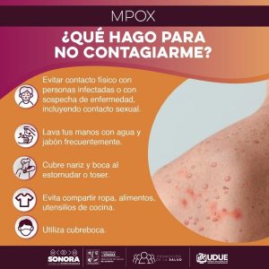 MPOX-4-1-900x900