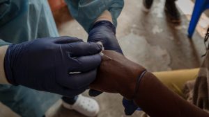 mpox-africa-registra-mas-de-18-mil-700-